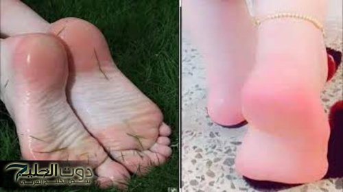 «ابهري جوزك بجمالك..!!» طريقة تبييض وتقشير اليدين والقدمين وإزالة الجلد الميت هتشوفي نعومة مذهلة.. جربيها مش هتندمي..!!