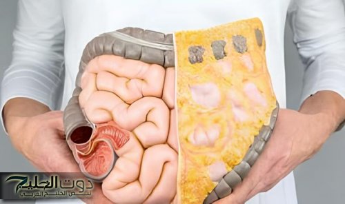 العشبة الخارقة لتنظيف القولون .. أفضل عشبة سحرية برخص التراب هتنضف القولون تماما وهتخلصك من البراز المتحجر في ثواني.. مش هتحتاج تروح لدكتور تاني