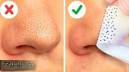 "وفرى فلوس جلسات تنضيف البشرة".. وصفة قوية لتنظيف الوجه والأنف من الرؤوس السوداء في 5 أيام فقط وعن تجربة .. جوزك هيموت فيكي !!