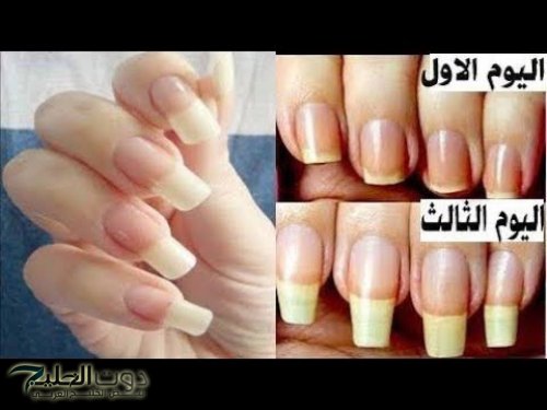 وداعًا للهارد چيل.. طريقة عمل وصفة زيت الزيتون لإطالة الأظافر وتقويتها ومنع كسرها إيدك هتزيد جمال