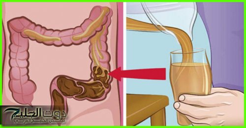 ضيعت عمرك وانت متعرفش .. عشبة طبيعية خارقة لتنظيف القولون نهائيا برخص التراب وتقضي علي البراز المتحجر والغازات من أول استخدام .. مش هتحتاج تروح لدكتور تاني