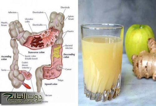 مشروب بيريح القولون على الاخر!!.. اقوى مشروب تنظيف وتطهير القولون من السموم سيخرج منك فضلات سنين في 3 أيام.. كان غايب عننا فين!!