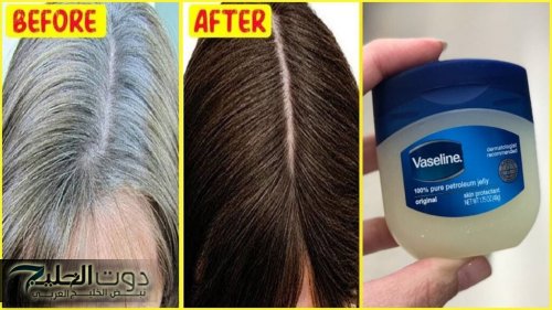 وداعًا للإحراج.. طريقة عمل ماسك الفازلين للتخلص من الشعر الأبيض والشيب خليكي دائمًا شباب