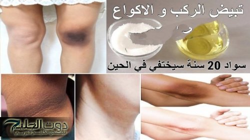 "السواد هيروح نهائيا".. اليكي افضل طريقة وافضل وصفة تقدري تشيلي بيها السواد من الركب والاكواع نهائيا.. مش هتشوفي سواد تاني!!