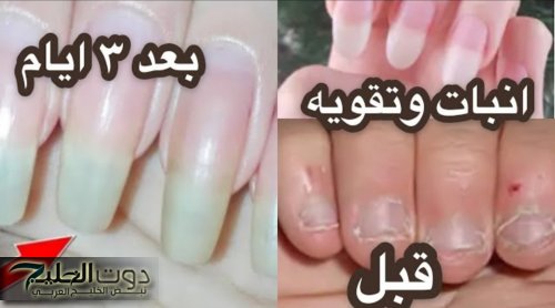 «جمالك هيعدي الكل..!!» وصفة فعالة لتقوية الاظافر وتطويلها في وقت سريع مضمونة وامنة 100% بمكونات طبيعية.. ما تروحيش صالونات تجميل وفري الفلوس..!!