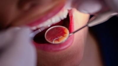 أعراض سرطان الفم