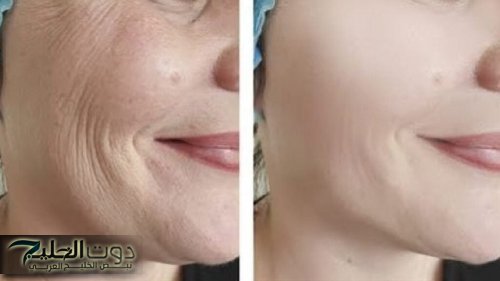 طريقة تفتيح البشرة والتخلص من التجاعيد بمكونات طبيعية واحصلي علي وجه مشرق بأقل وقت