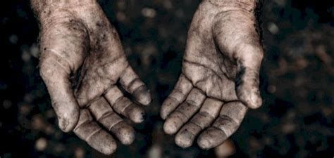 تفسير الحكة في الحلم معنى الهرش في المنام