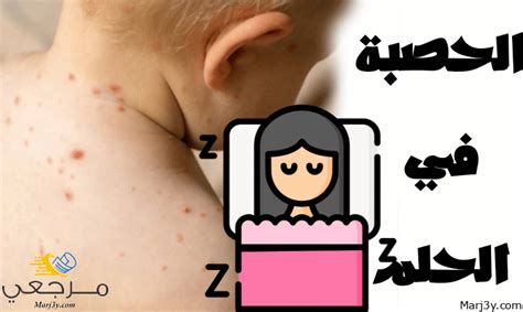 تفسير الحصبه في الحلم رؤيا مرض الحصبة في المنام