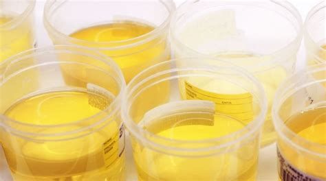 تفسير البول في الحلم معنى رؤيا البول في المنام