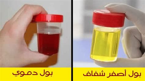 تفسير البول في الحلم معنى رؤيا البول في المنام