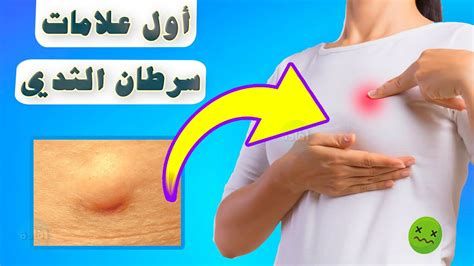 العرق والحمل