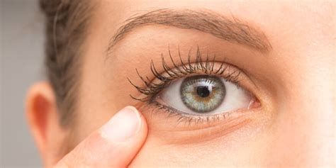 التخلص من انتفاخ العين نهائياً