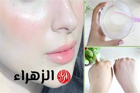 التخلص من انتفاخ العين نهائياً