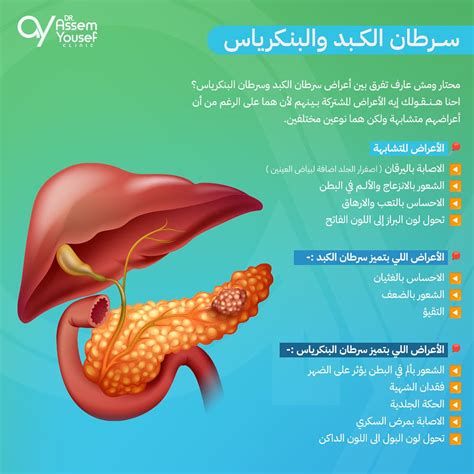 التخلص من انتفاخ العين نهائياً