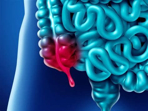 الزايده في انهي جنب