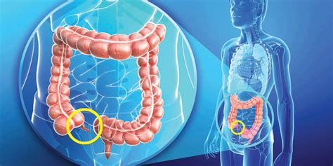 الزايده في انهي جنب