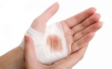 الجرح في المنام بدون دم