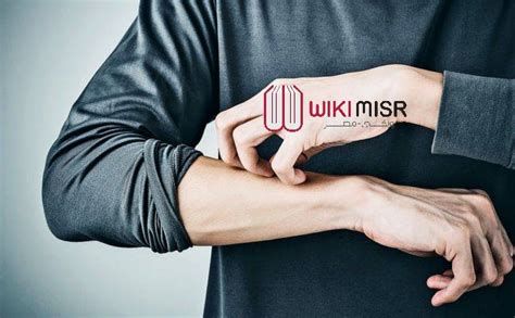 أفضل علاج لإزالة الكدمات من الوجه وتحت العين