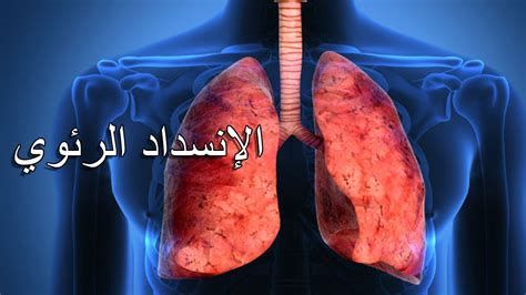 ألم في القلب وخلف الظهر