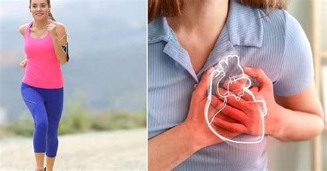 أفضل علاج لإزالة الكدمات من الوجه وتحت العين