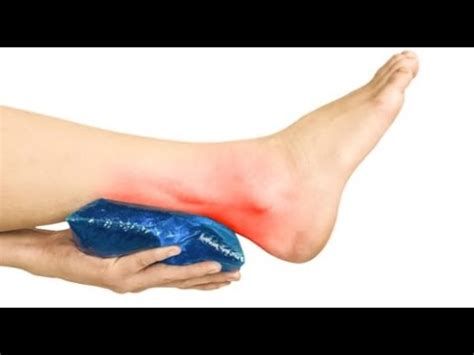 أفضل علاج لإزالة الكدمات من الوجه وتحت العين