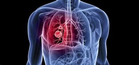 ألم في القلب وخلف الظهر