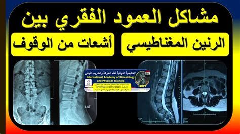 ألم في القلب وخلف الظهر