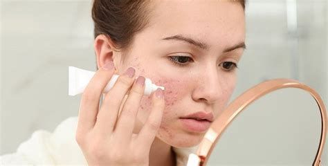 أفضل مضاد حيوي للحبوب تحت الجلد