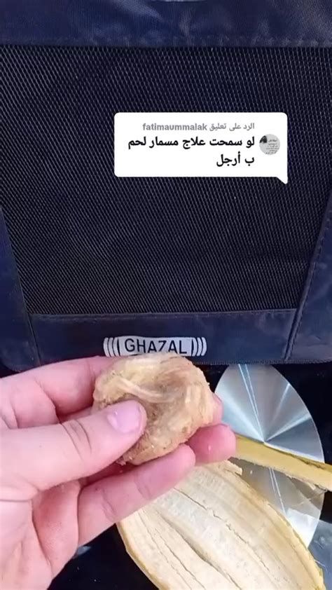 أفضل علاج لإزالة الكدمات من الوجه وتحت العين