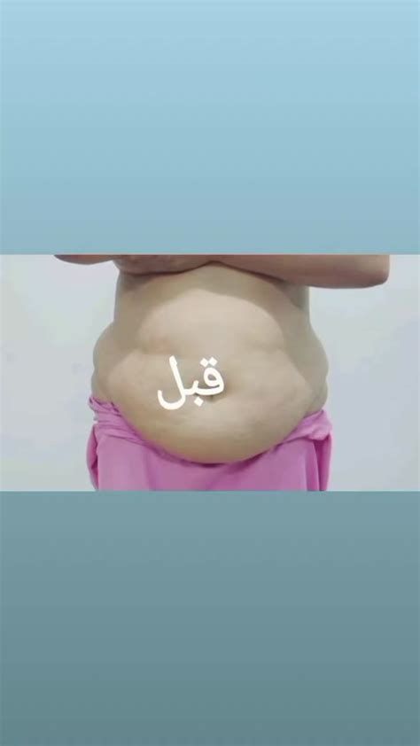 أفضل الأعشاب لحرق الدهون