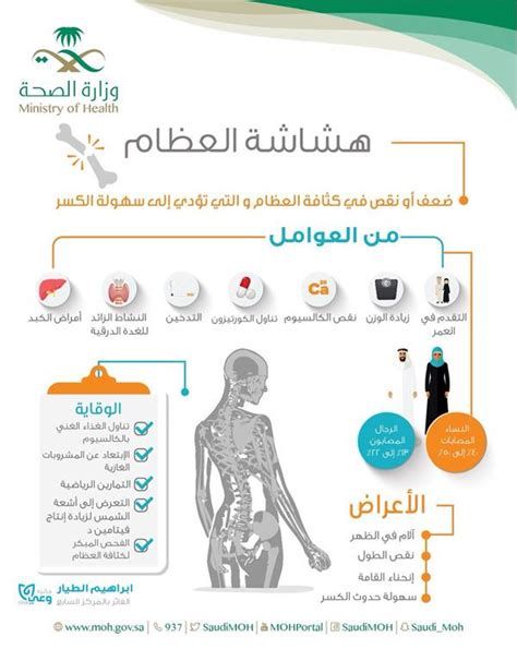 أفضل حبوب لهشاشة العظام