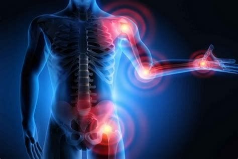 أفضل مسكن للعظام والعضلات