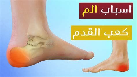 أفضل مسكن لآلام القدم