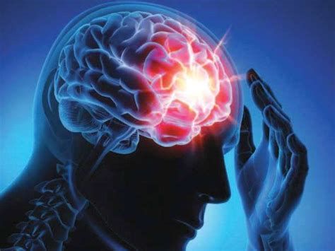 أعراض الصرع الجزئي