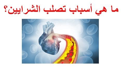 أعراض انسداد الشرايين عند النساء