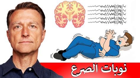أعراض الصرع الجزئي