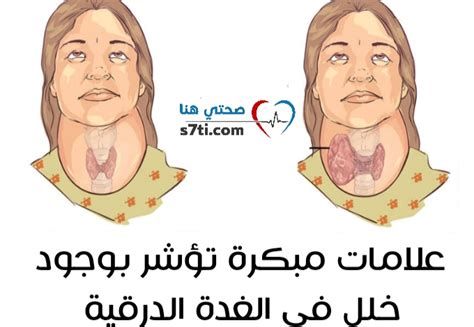 أعراض خلل الغدة الدرقية