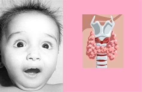 أعراض خلل الغدة الدرقية