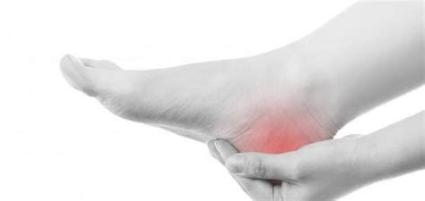 أعراض النقرس في كعب القدم