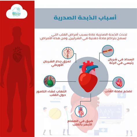 أعراض الذبحة الصدرية عند النساء