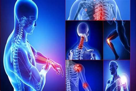 أعراض الروماتيزم في الظهر