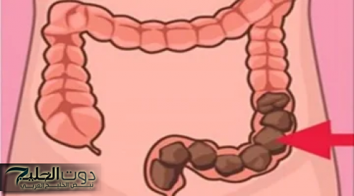 "حل جبار يغنيكي عن الدكاترة!"... شابة أردنية تكشف عن عشبة جبارة موجودة في كل مطبخ تنظف القولون في 5 دقائق وتعتبر الحل الأمثل للتخلص من البراز المتحجر!