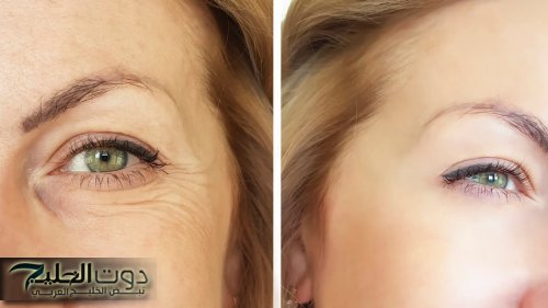 "سر جمال المغربيات"... طريقة عمل كولاجين منزلي يخلصك من تجاعيد الوجه و العين والانتفاخات والهالات