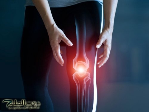 خفف ألم مفاصلك.. أطعمة ومشروبات تدعم صحتك وتقلل الالتهاب