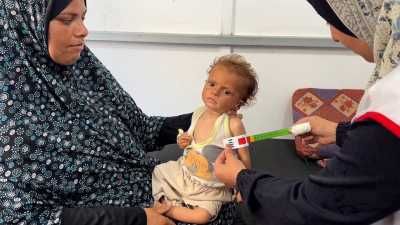 أخبار اليمن : طفل من كل 10 يعاني سوء التغذية في غزة