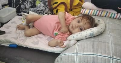 أخبار اليمن : 70 ألف طفل بغزة يعانون من سوء التغذية الحاد