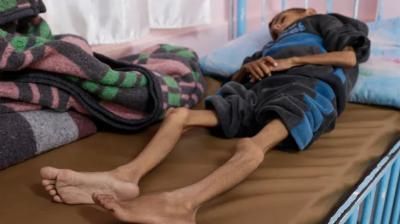 أخبار اليمن : غزة.. 900 ألف طفل يعانون من الجوع