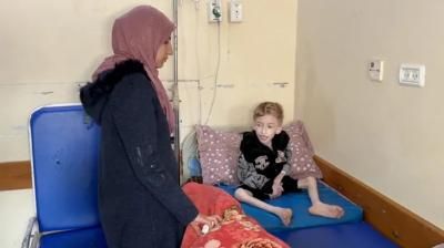 أخبار اليمن : منظمة الصحة: ارتفاع "قاتل" في سوء التغذية بغزة