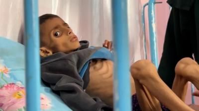 أخبار اليمن : 122 شهيداً جراء التجويع في غزة